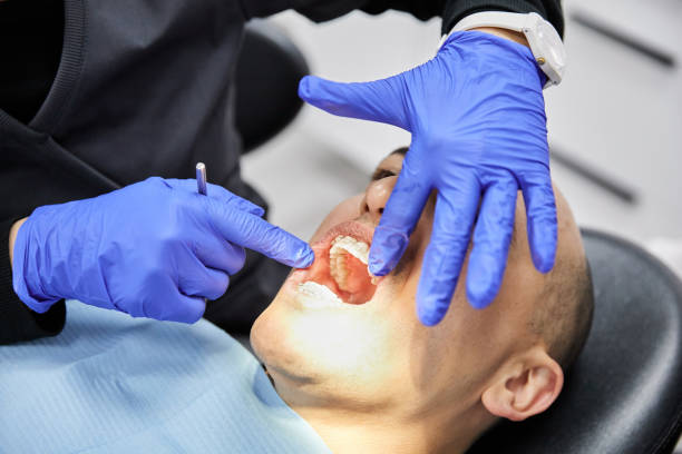 Best Broken or Cracked Tooth Emergency Dentist in Bunker Hill, OR